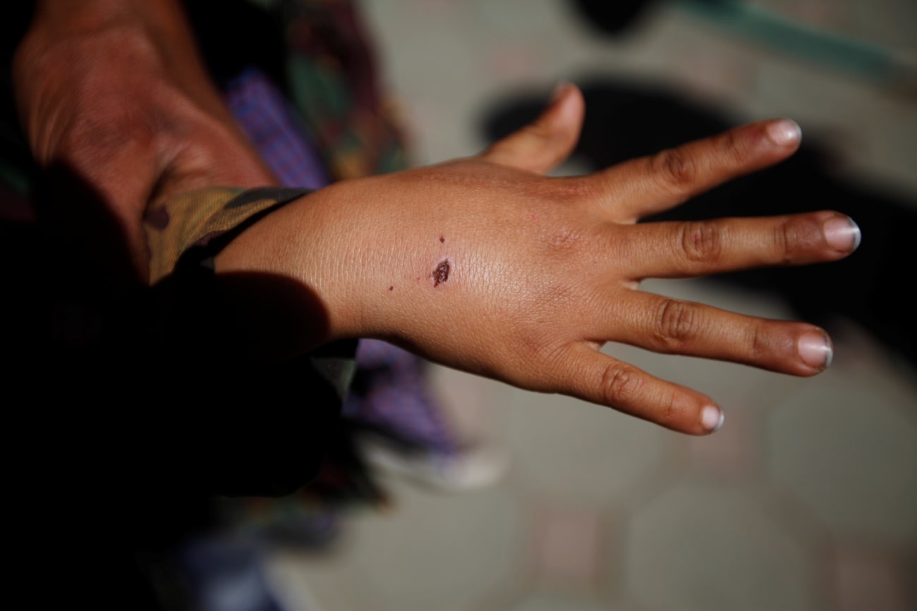 Digitizing Supply Chains—Down to the Last Mile—to End Neglected Tropical Diseases