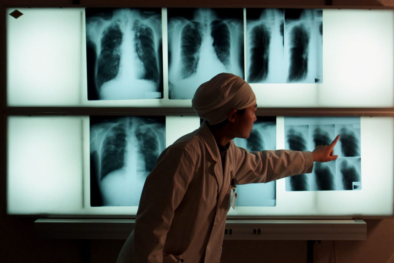 A Fight Unfinished: The Legacy of Tuberculosis