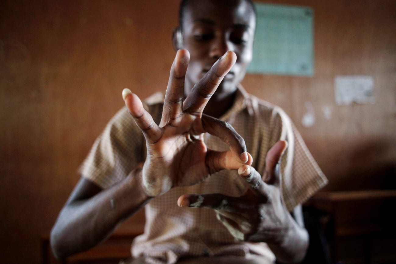 A New Era of Support for Deaf People Through Deaf Leadership