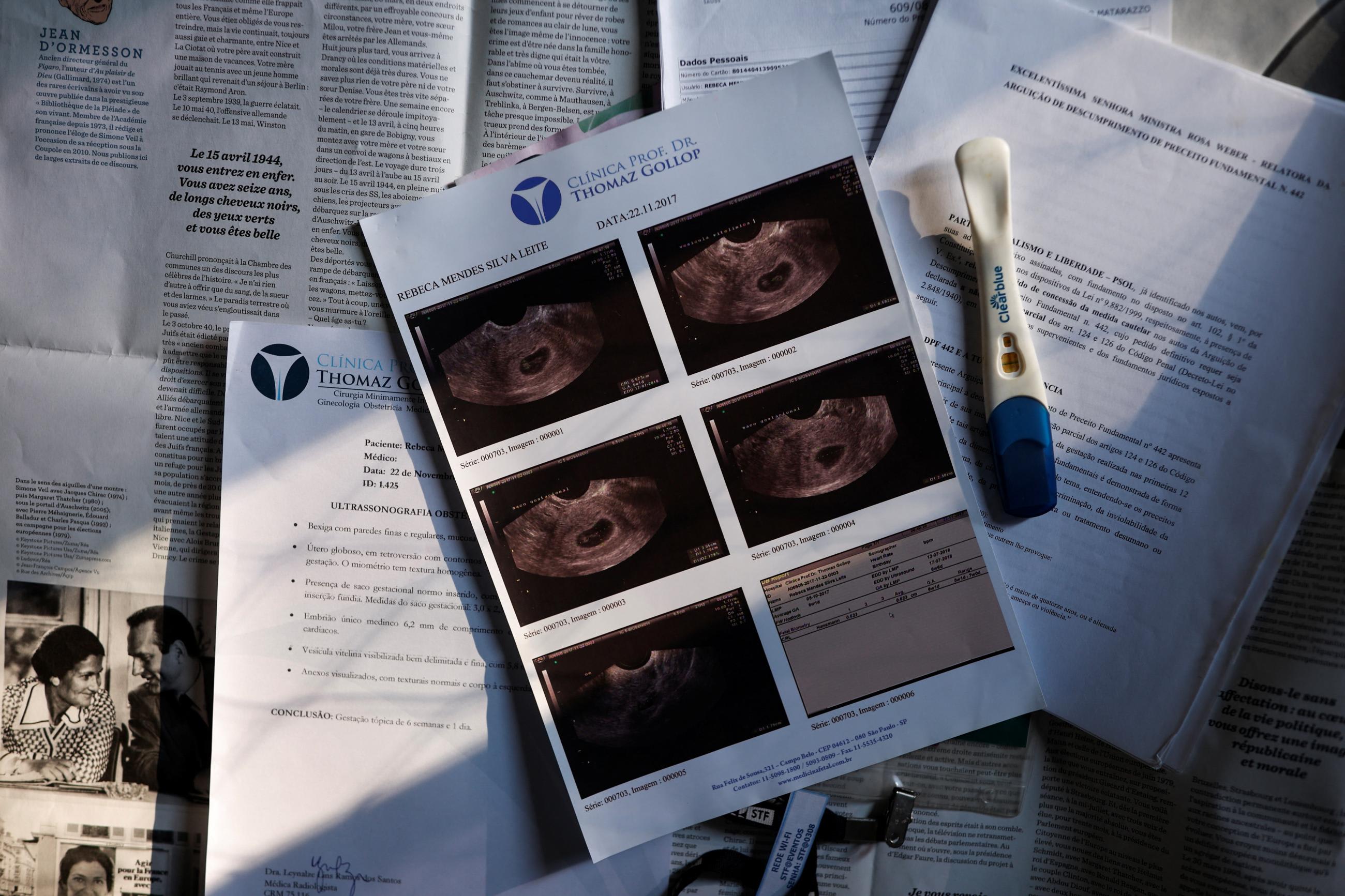 Rebeca Mendes' ultrasound and pregnancy test reports lie on her bed. She is the first Brazilian woman to demand a legal abortion in the country, in Sao Paulo, Brazil, on July 10, 2024.
