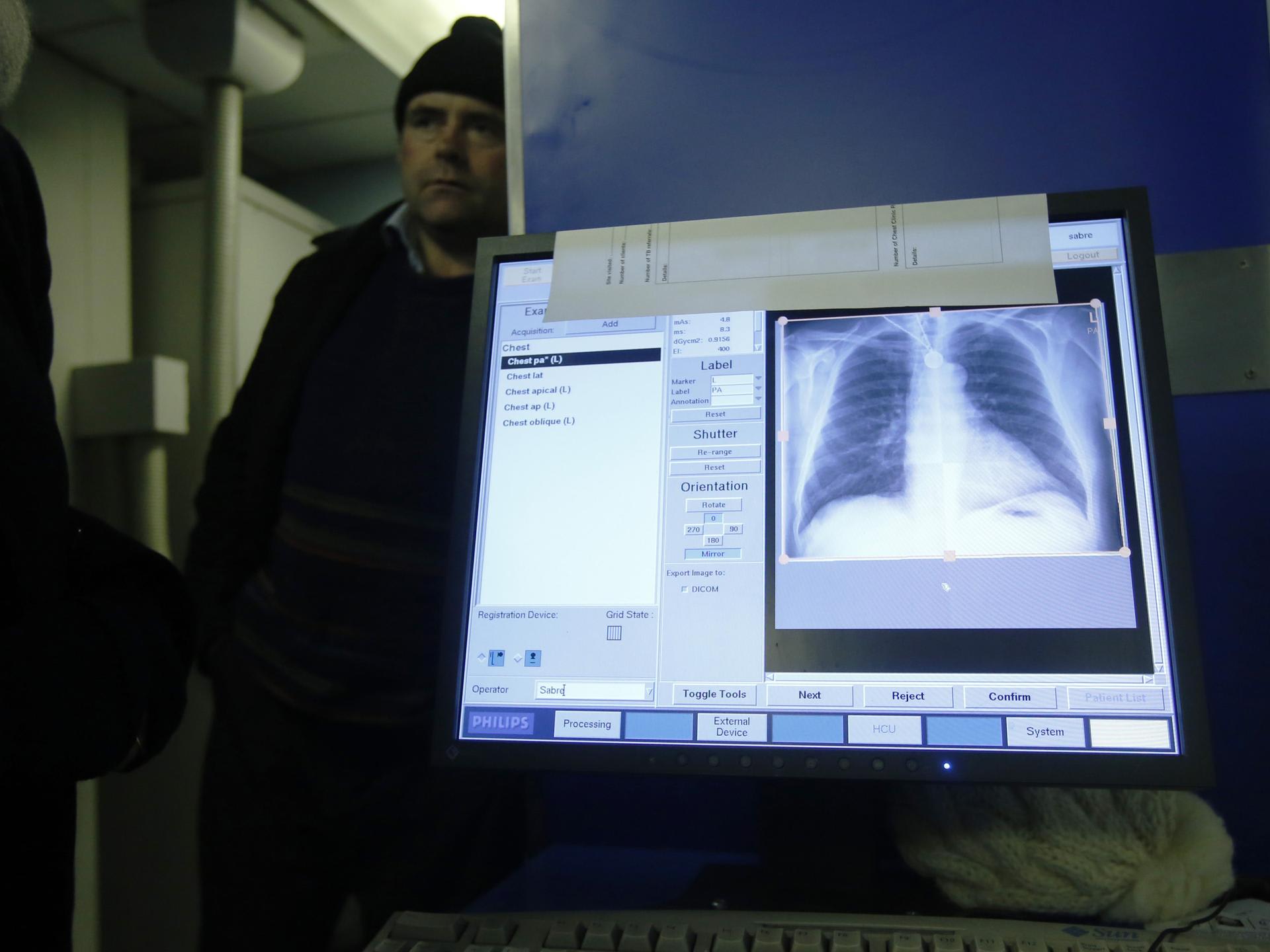 An X-ray scan is shown on a computer after a screening for tuberculosis, in London, England, on January 27, 2014. 