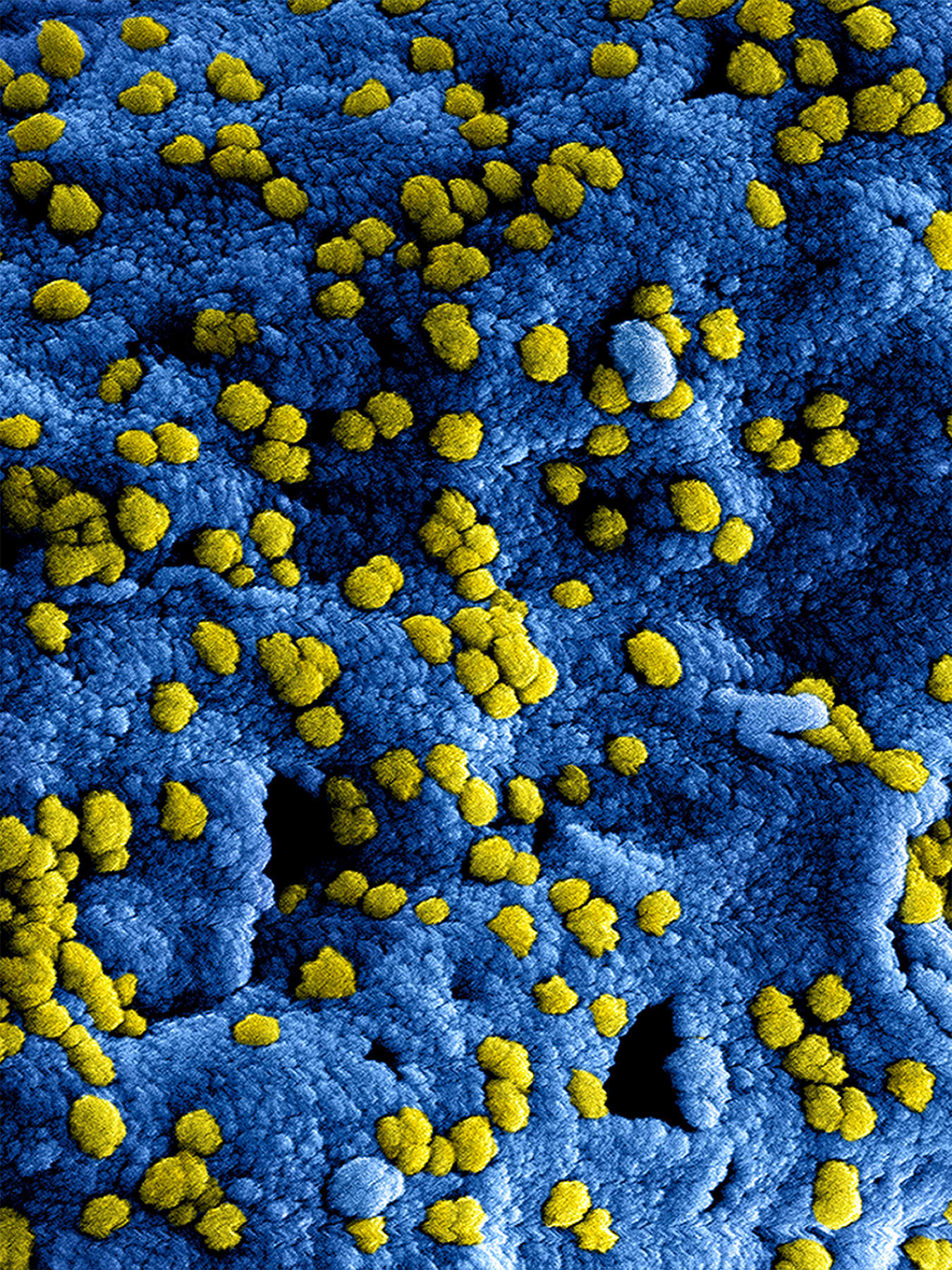 The image is a rich blue rough surface with numerous bright yellow viral dots. This is a stunning image. 