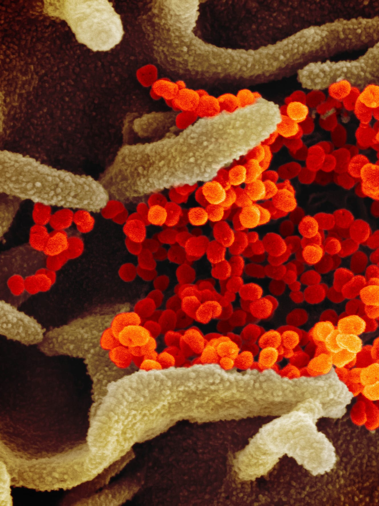 Image shows a colorful molecular world with a bunch of worm-like dendrites, presumably biological material like cells, and bright orange cluster of spheres in the middle of the image.
