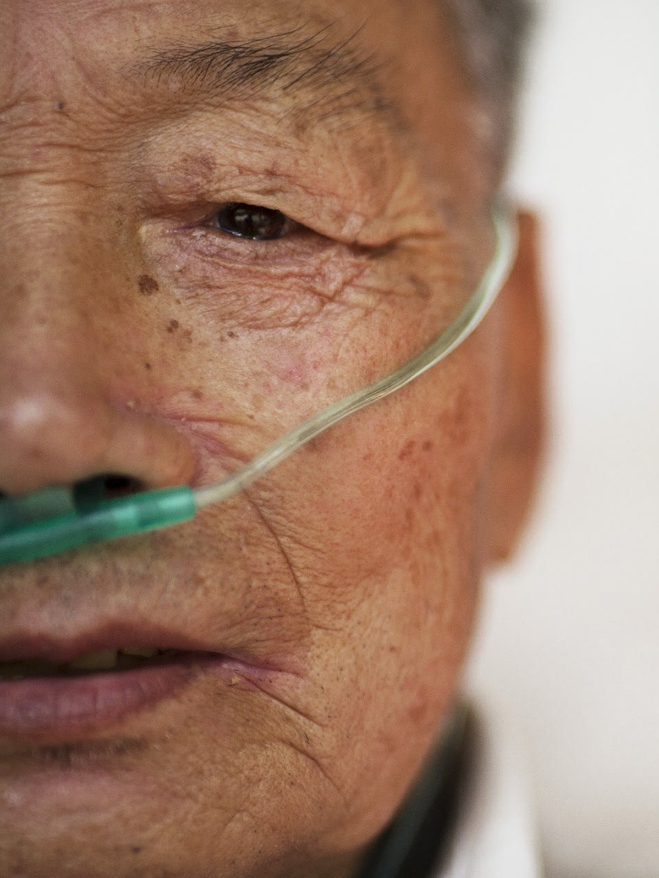 Hu Hushen, a seventy-eight-year-old former miner, breathes using a nasal cannula for oxygen supply outside his room at Yangjia Hospital in Wuyi County, Zhejiang Province, China, on October 19, 2015.