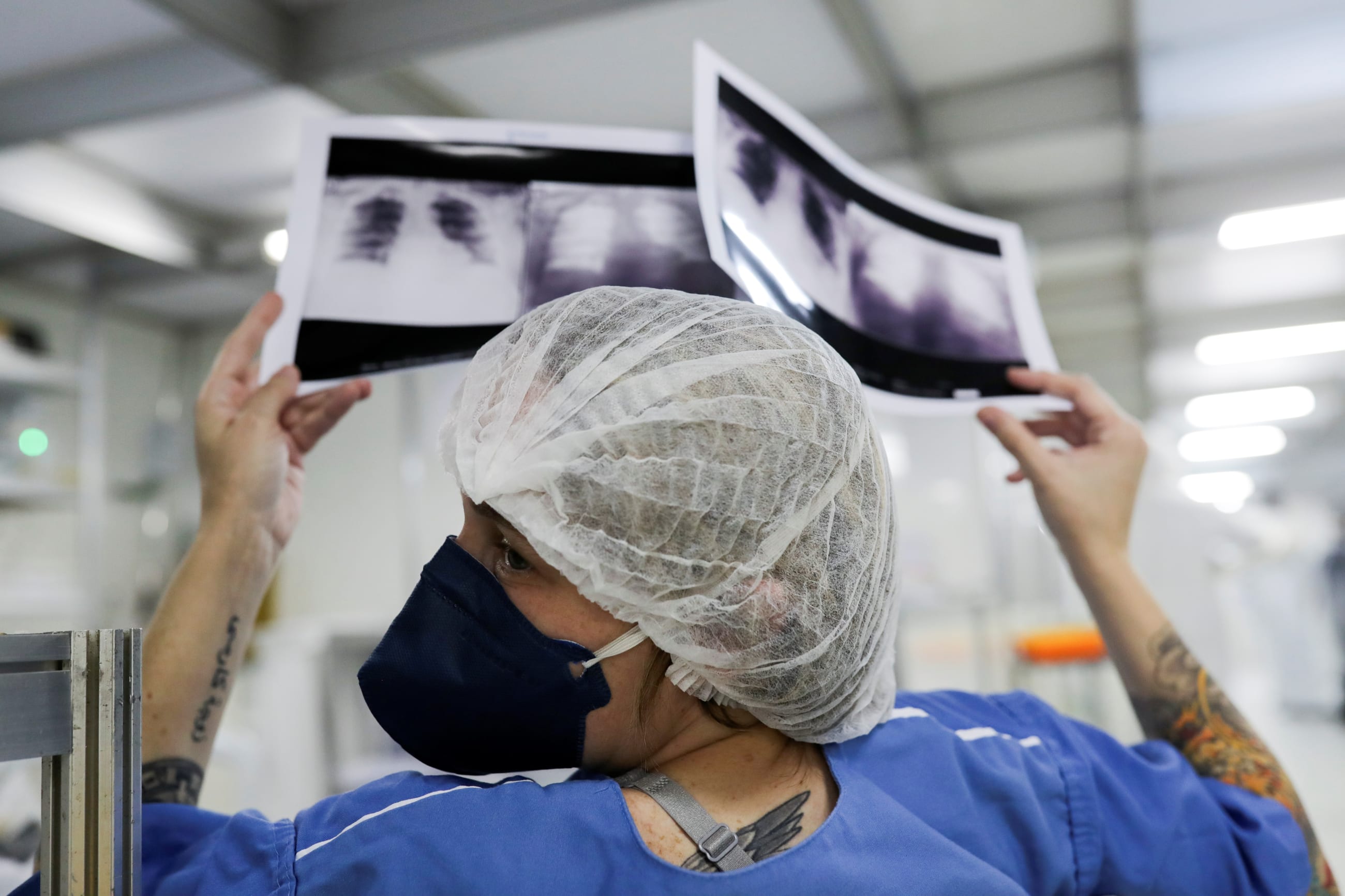 Luciana Souza, MD, compares two different chest x-rays of a patient as she talks to a colleague at a field hospital set up to treat COVID-19 patients.