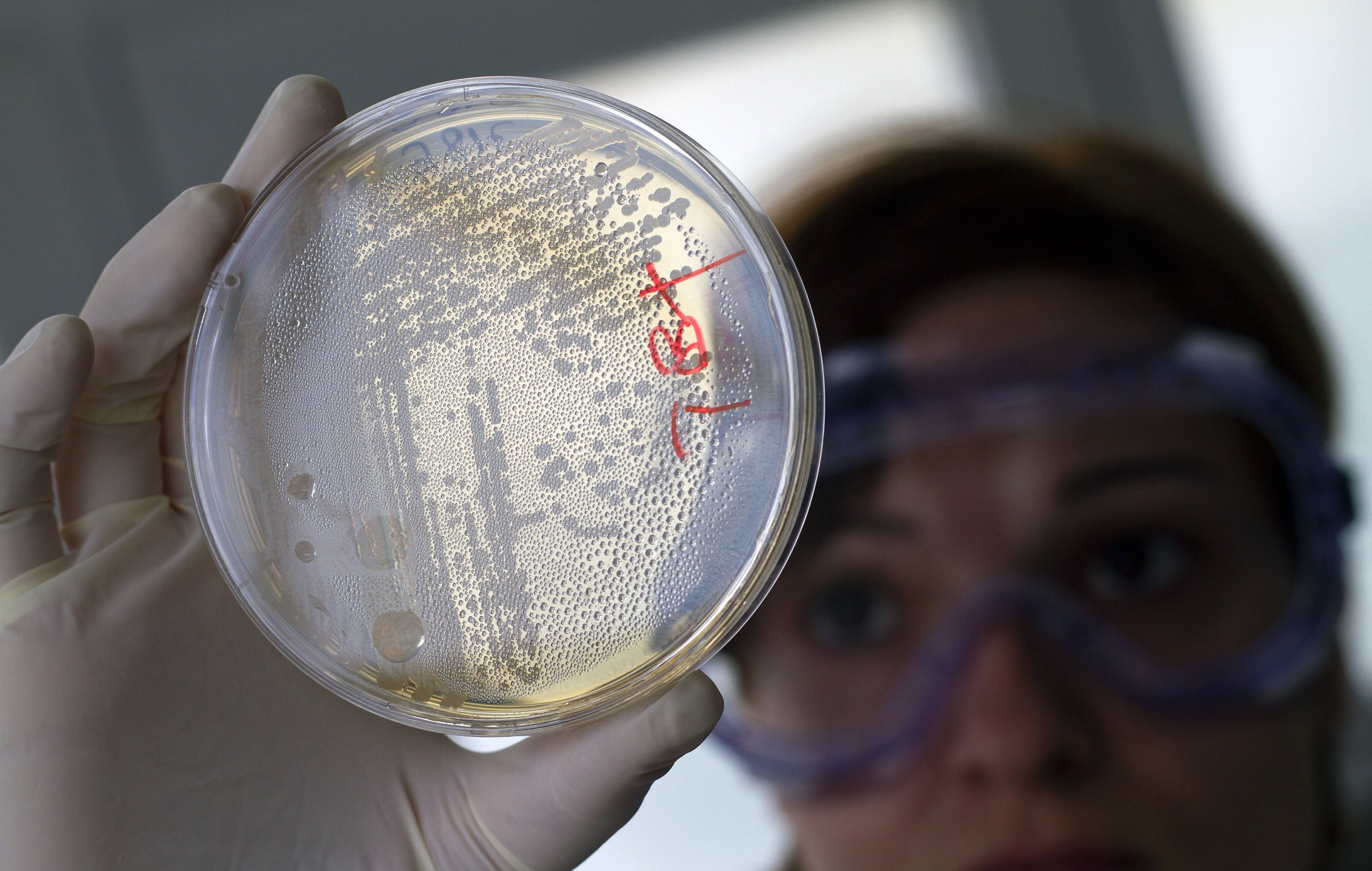 A laboratory worker looks for strains of E.coli bacteria in vegetable cells placed in a petri dish, in La Mojonera, Spain, on June 2, 2011.