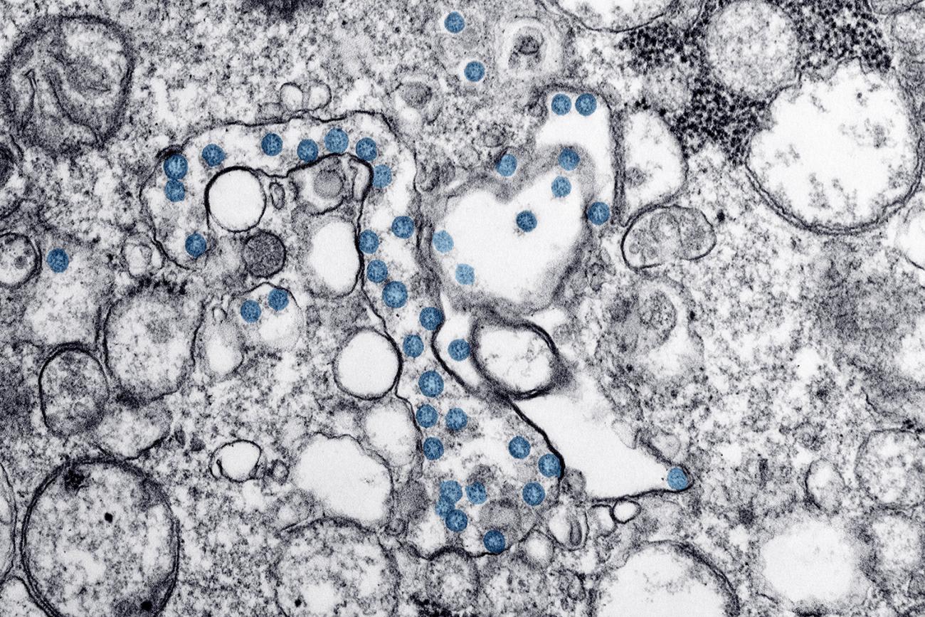 The image is a micrograph showing tissue/cell samples.