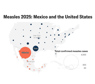A map shows confirmed measles cases in Mexico and the United States from January to mid-August 2025, with circle sizes representing total cases by state. In Mexico, Chihuahua has the largest circle in the country—much larger than any other federal state—indicating it has four and a half times more cases than Texas despite having about one-tenth its population. Chihuahua’s circle is bright orange, while Texas’s circle is dark blue and smaller. A legend shows reference circles for 40, 400, and 4,000 cases.