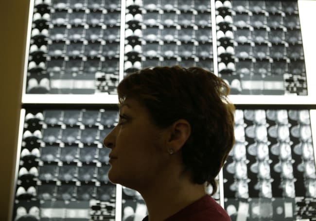 AI Gains Ground with Breast Cancer Diagnosis and Prevention