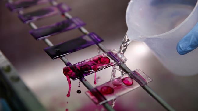 A health technician analyses blood samples for tuberculosis testing in a high-tech TB laboratory in Carabayllo, an area in Lima, Peru on May 19, 2016. The image shows a splashing liquid being washed across glass plates each of which is dotted with what appears to be a blood drop sample. REUTERS/Mariana Bazo
