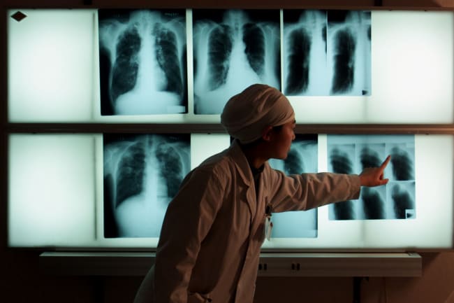 A Fight Unfinished: The Legacy of Tuberculosis