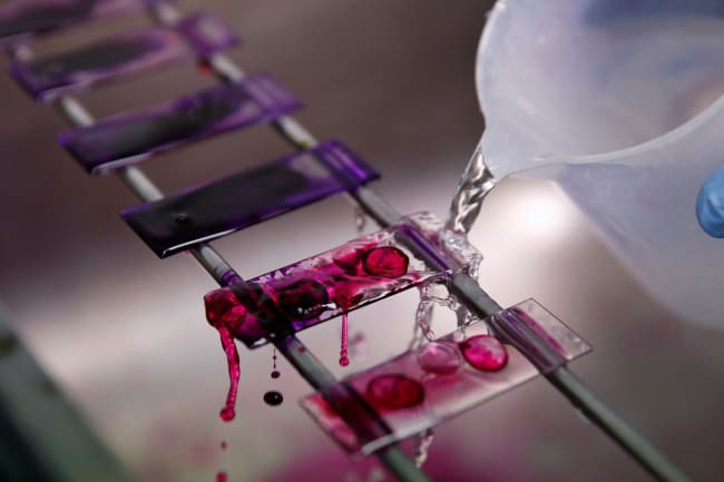 A health technician analyses blood samples for tuberculosis testing in a high-tech TB laboratory in Carabayllo, an area in Lima, Peru on May 19, 2016. The image shows a splashing liquid being washed across glass plates each of which is dotted with what appears to be a blood drop sample. REUTERS/Mariana Bazo
