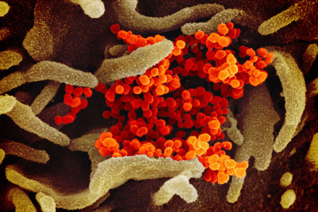 A colorized scanning electron microscope image of the novel coronavirus SARS-CoV-2, also known as 2019-nCoV, which causes COVID-19. Image shows a colorful molecular world with a bunch of worm-like dendrites, presumably biological material like cells, and bright orange cluster of spheres in the middle of the image. NIAID-RML image
