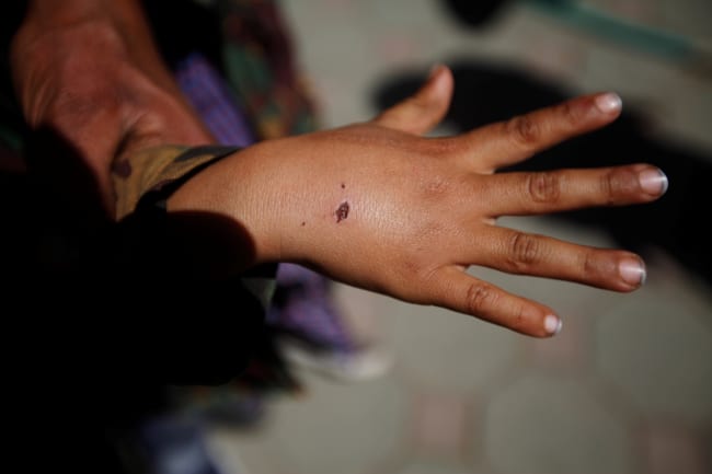 Digitizing Supply Chains—Down to the Last Mile—to End Neglected Tropical Diseases