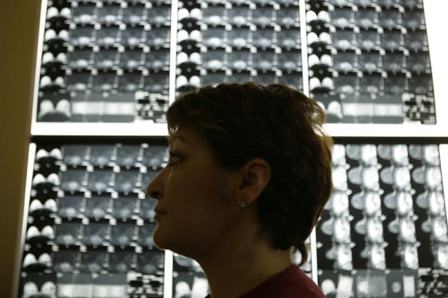 AI Gains Ground with Breast Cancer Diagnosis and Prevention