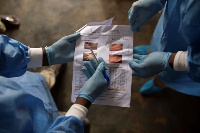 What South Africa&#039;s Fatal Mpox Cases Mean for the Global Crisis