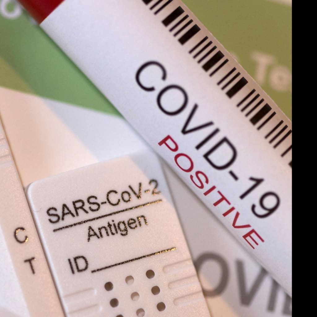 <p>Rapid SARS-CoV-2 antigen test kits are seen in this illustration</p>
