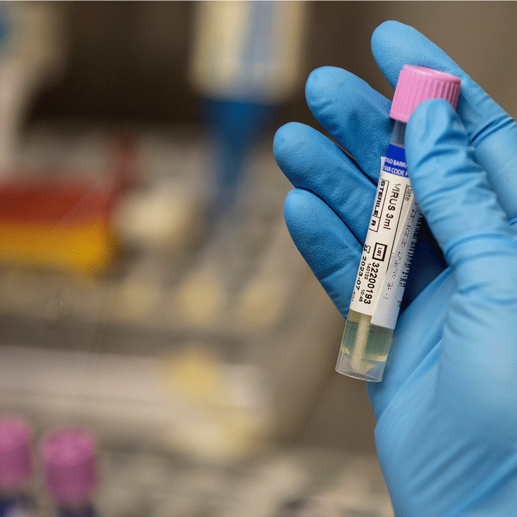 A medical laboratory in Spain for monkeypox testing