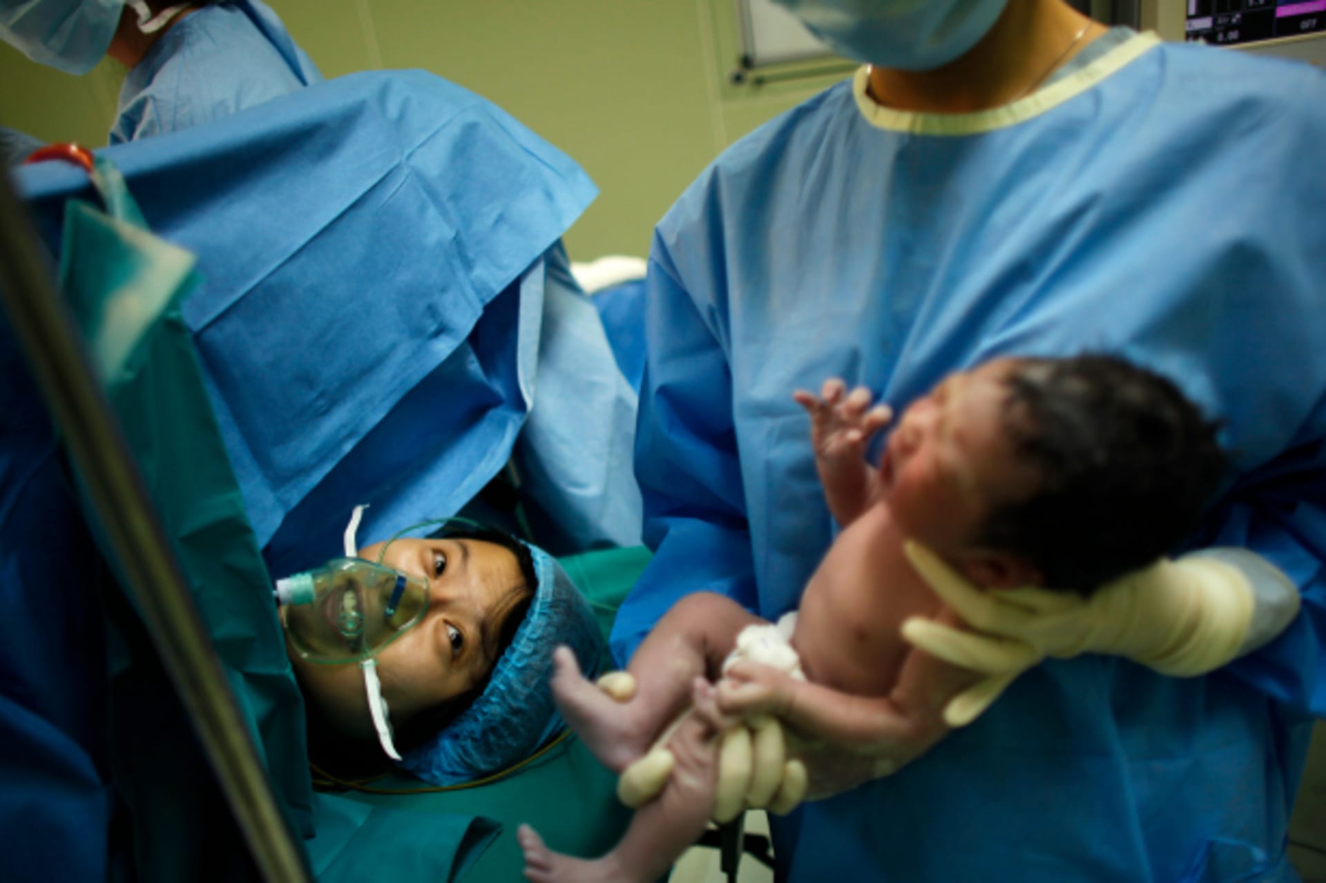 <p>Yang Huiqing looks at her baby after a cesarean section in Ruijin Hospital in Shanghai</p>
