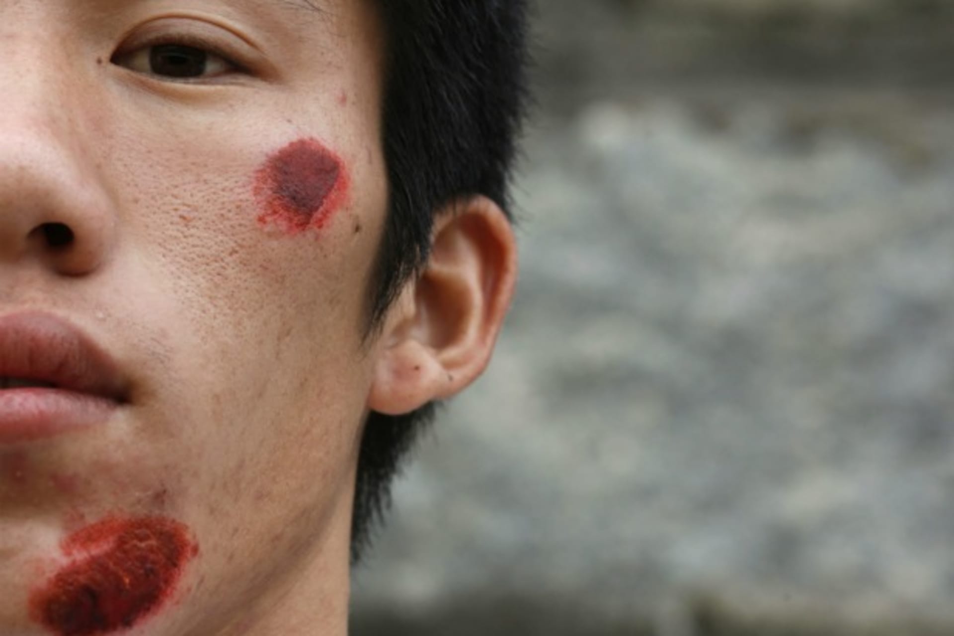 <p>A wounded villager from Wukan is seen after a riot with the police the day earlier on September 23, 2011.</p>
