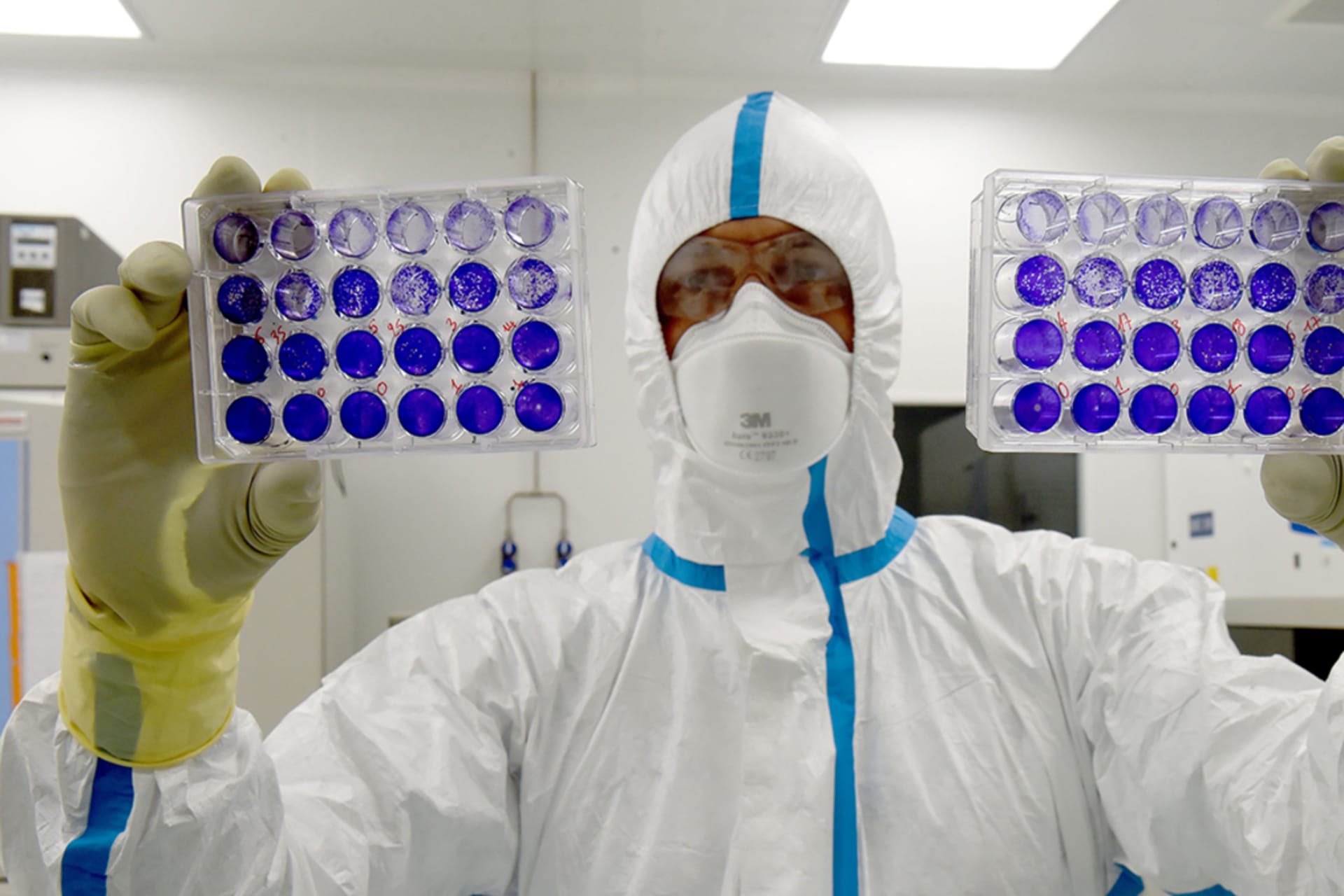 <p>French engineer-virologist Thomas Mollet examines cells infected with a Sars-CoV-2 virus at the Biosafety level 3 laboratory in Saint-Herblain, France.</p>
