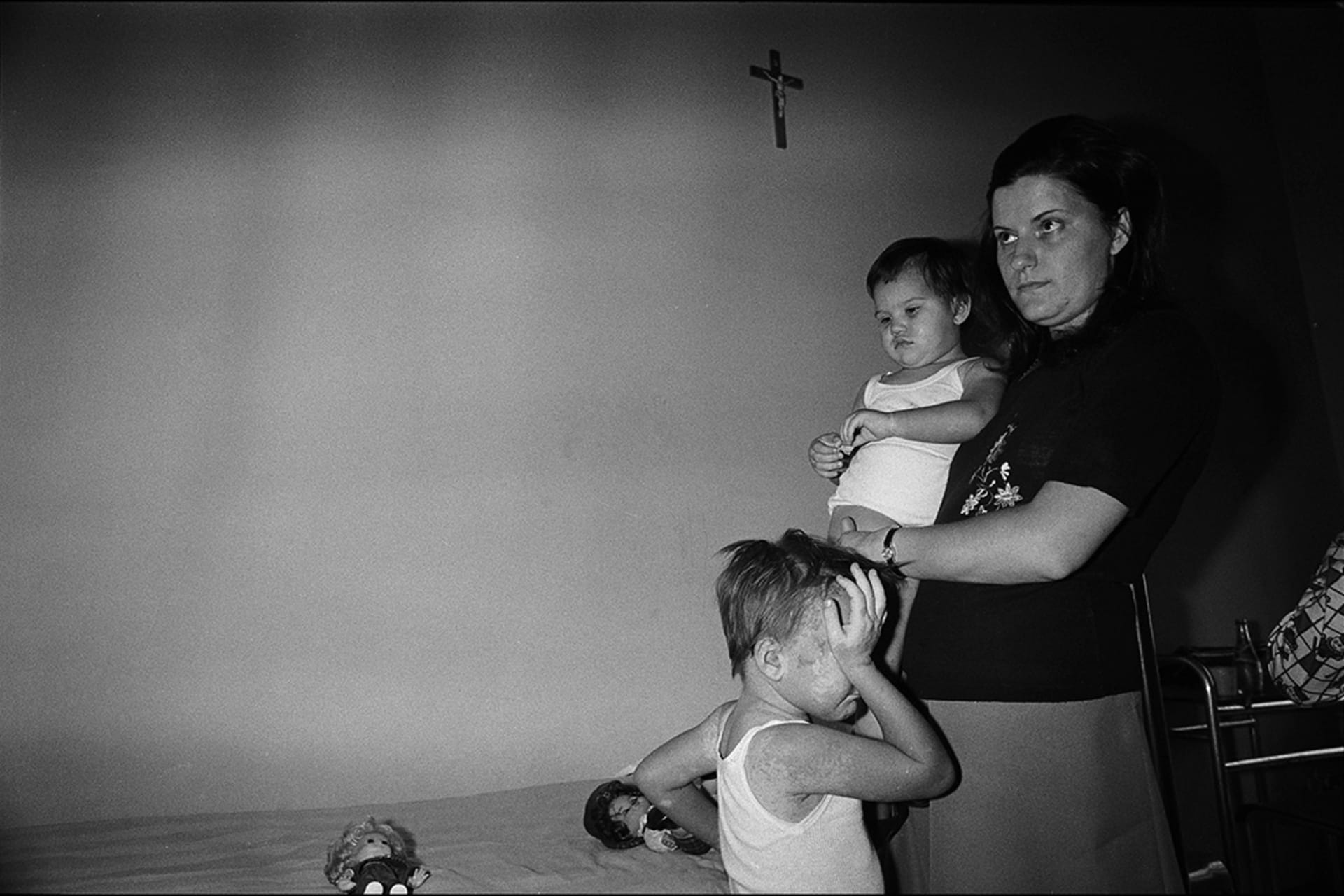 A four-year-old, standing with her mother and sister, suffers from burns caused by a poisonous cloud of chemicals that spread from a Swiss-owned firm in 1976. 