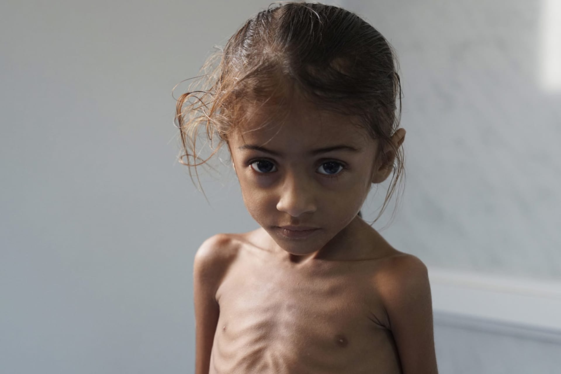 What’s Causing a Humanitarian Crisis in Yemen?