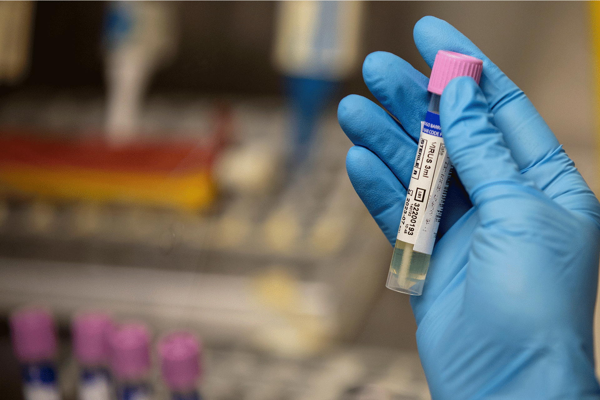 A medical laboratory in Spain for monkeypox testing
