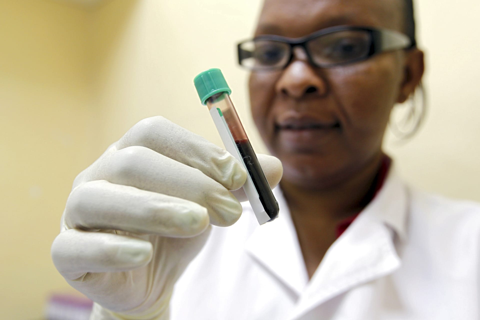 <p>Mishi Mohammed, a phlebotomist, holds a blood sample from a woman to test for HIV at the Mater Hospital in Kenya, September 10, 2015. </p>