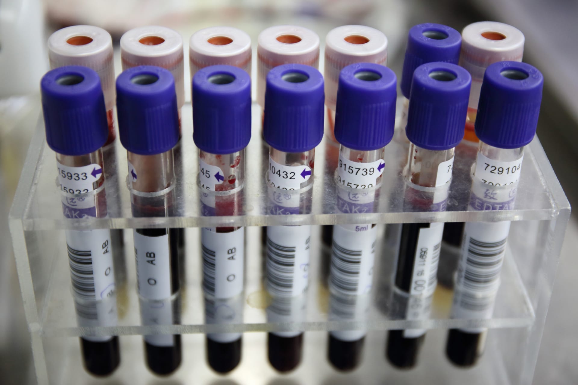 <p>Vials of blood samples are seen during a blood donation drive for medical staff at a hospital in Fuzhou, Fujian province on January 27, 2015.</p>
