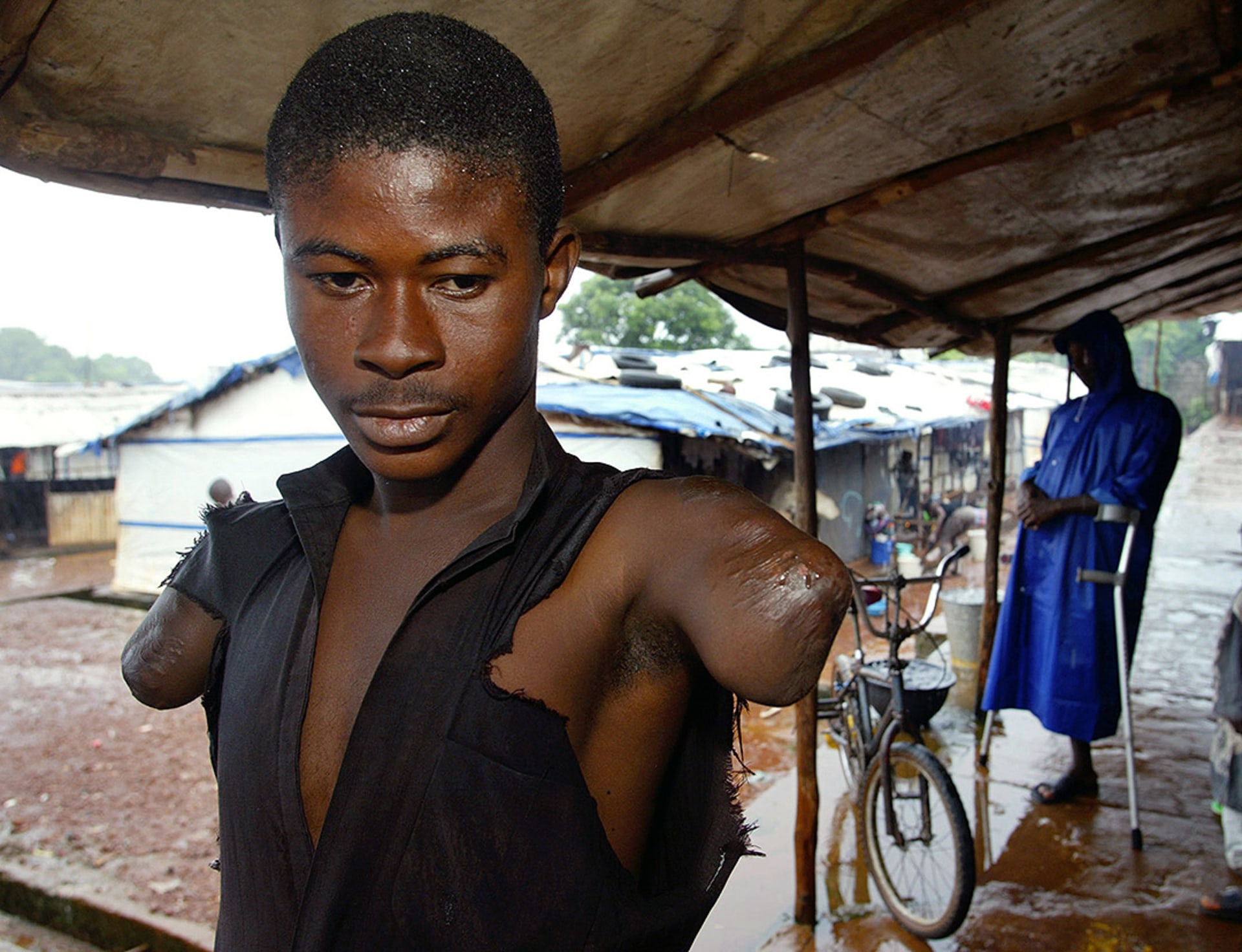 An amputee victim of Sierra Leone’s civil war at a camp in Freetown, Sierra Leone.