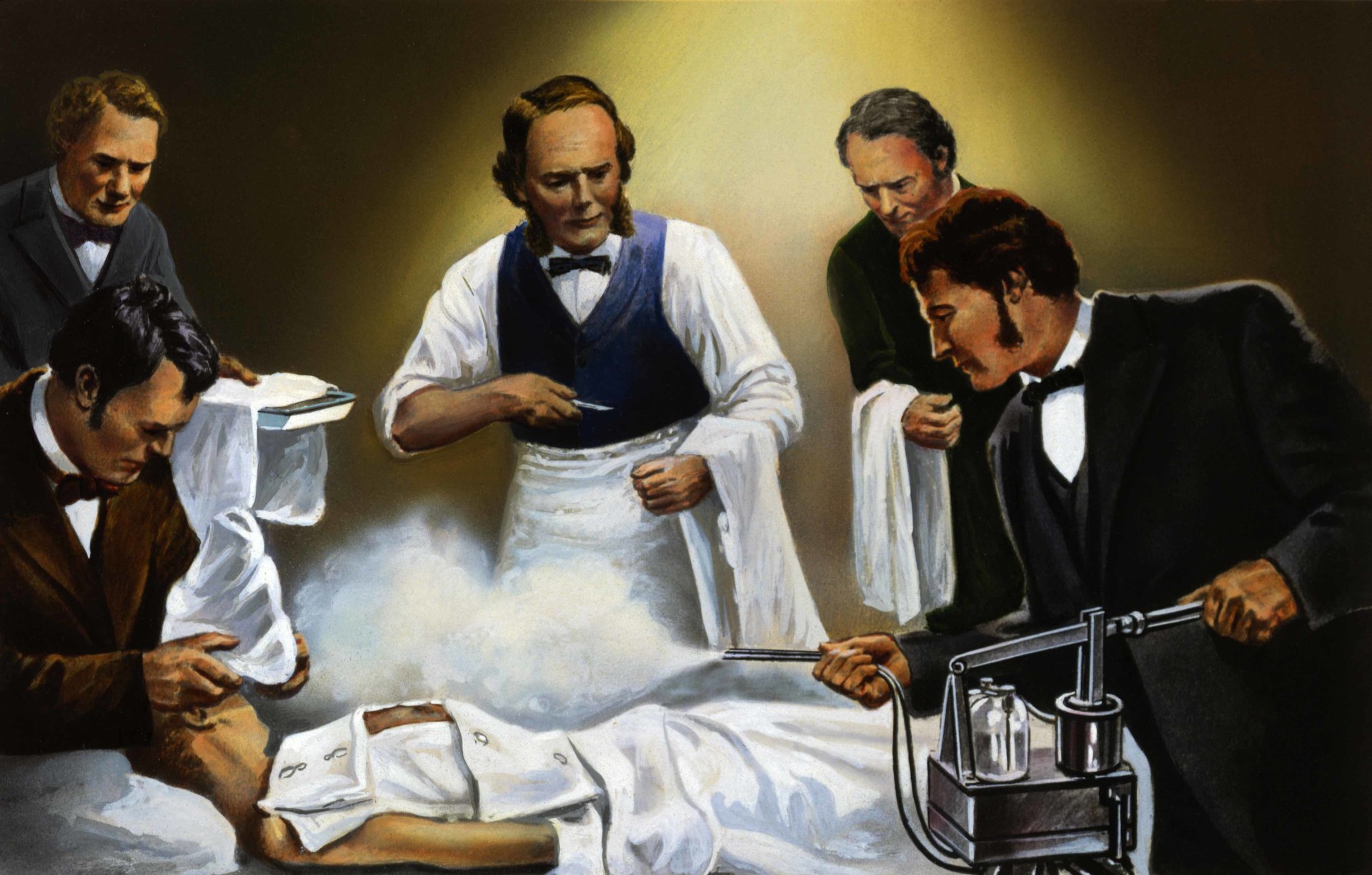 An illustration of Joseph Lister directing the use of carbolic acid spray during a surgery. Other medical professionals gather around the patient, who lays in the center covered by white cloth.