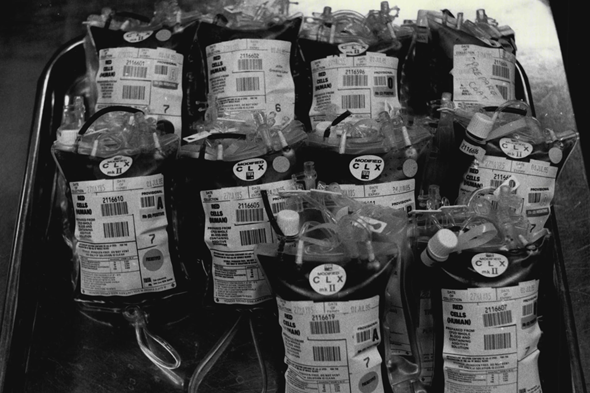 A batch of collected blood in 1985, after a test for HIV antibodies finally became available.