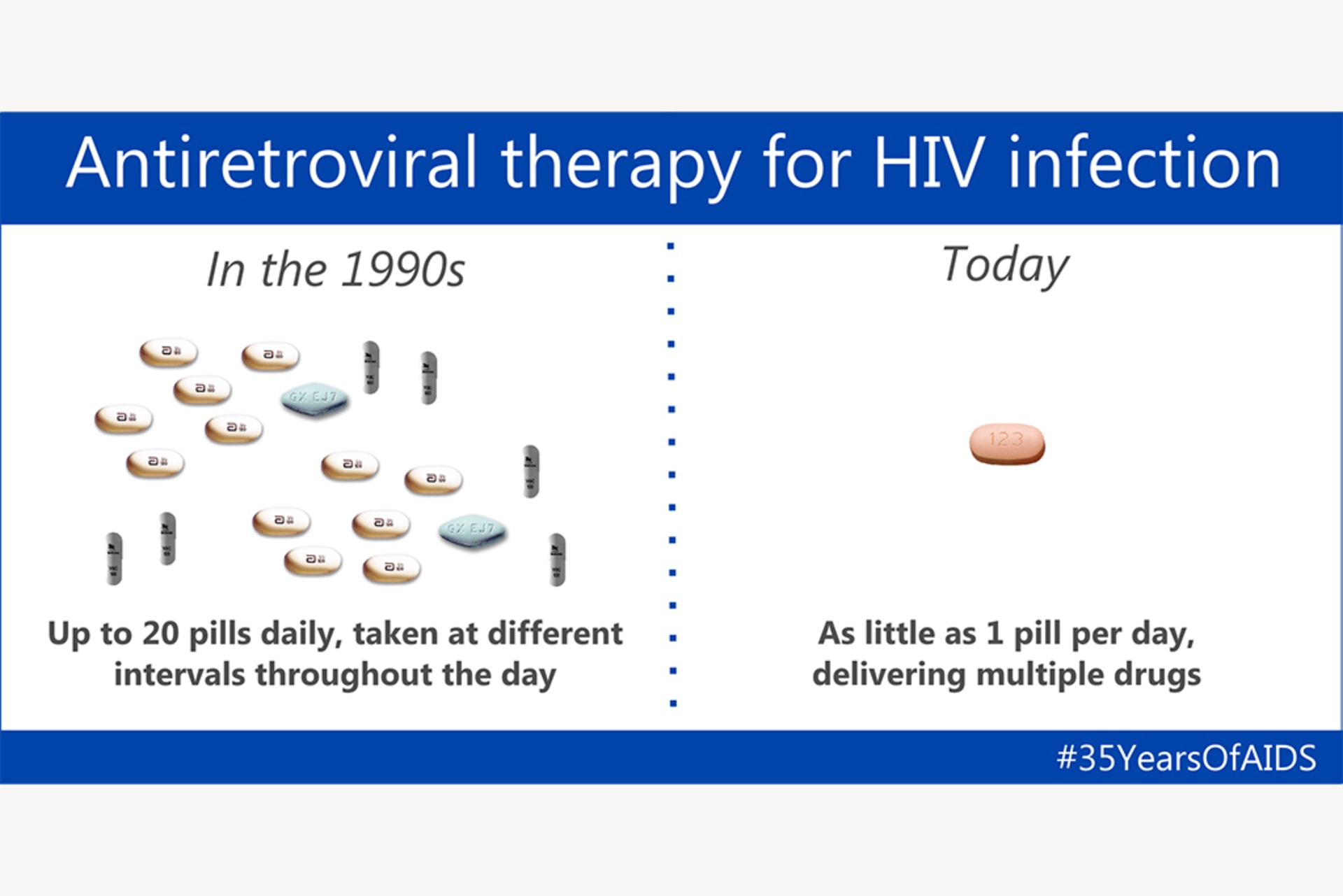 A graphic showing a comparison of antiretroviral therapy for HIV infection in the 1990s and today. The 1990s side shows 20 pills or varying kind and the today side shows just one that offers all the same benefits.