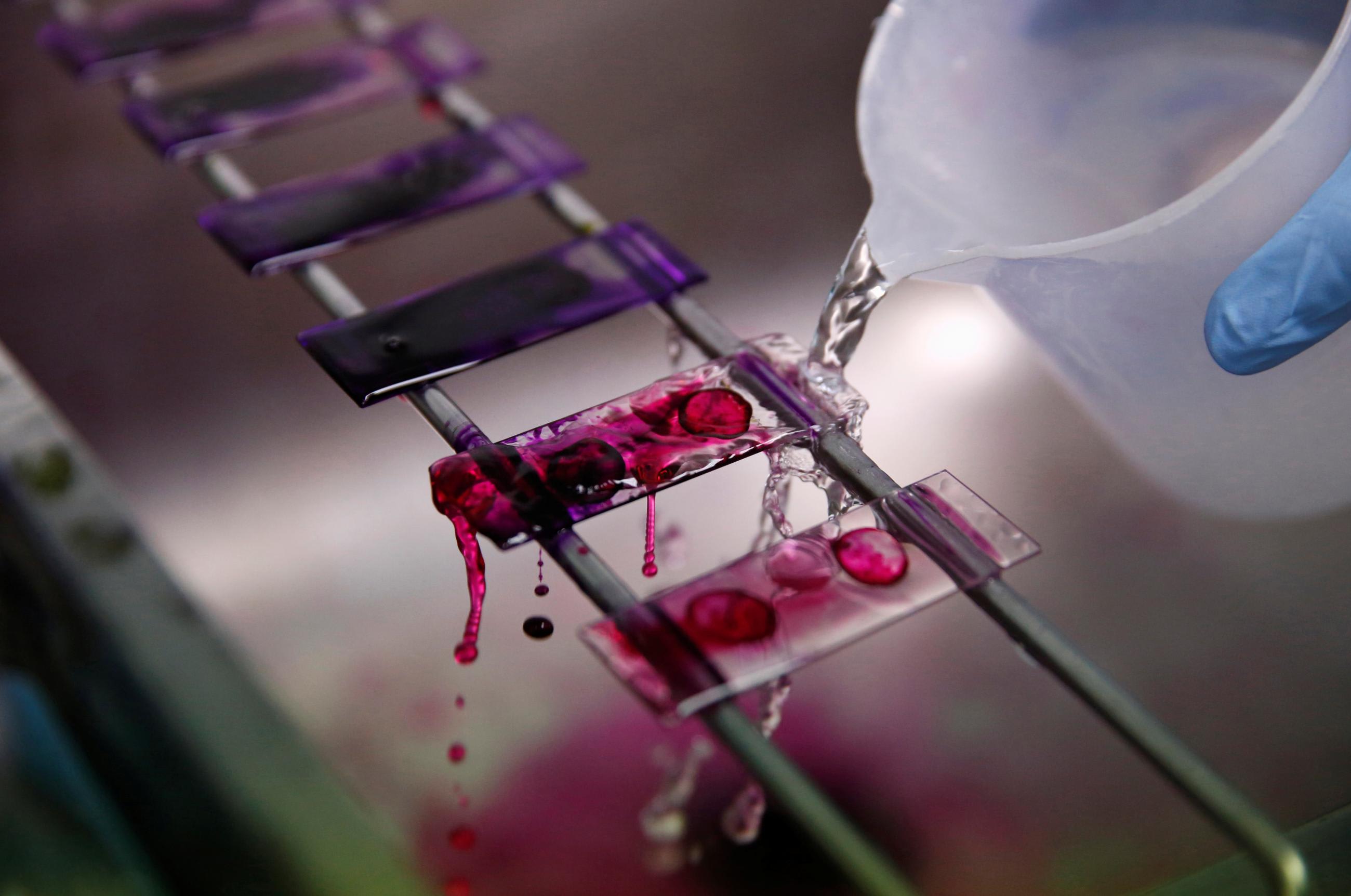 A health technician analyses blood samples for tuberculosis testing in a high-tech tuberculosis lab in Carabayllo, in Lima, Peru, on May 19, 2016.
