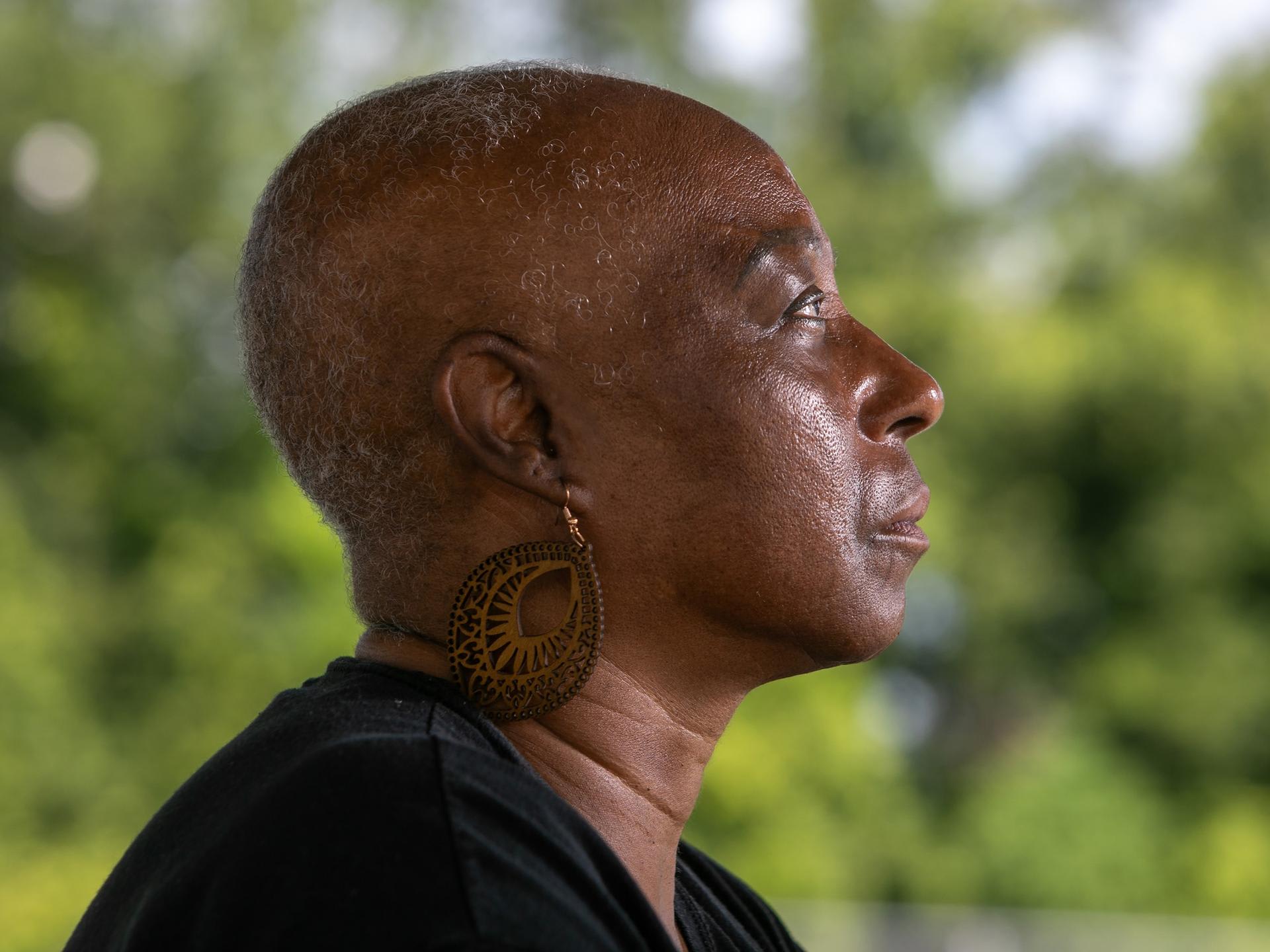 Veronica Jones, a survivor of aggressive breast cancer walks her neighborhood, in Convent, Louisiana, on June 26, 2025.