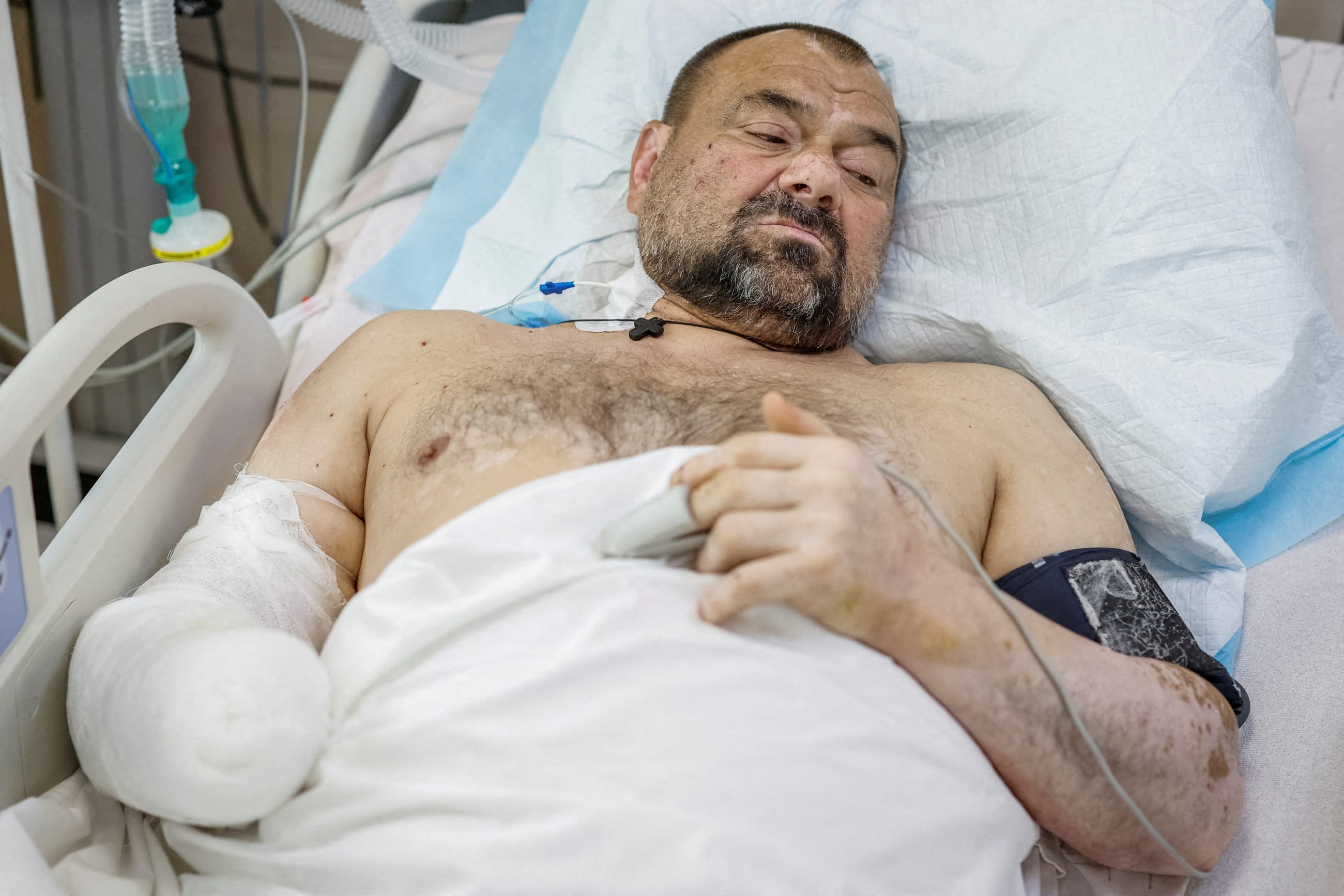 Viktor Cherniy, 52, a serviceman, wounded during fighting with Russian forces, and patient of the Mechnikov Hospital rests in an intensive care unit, amid Russia's attack on Ukraine, in Dnipro, Ukraine, on May 14, 2025.