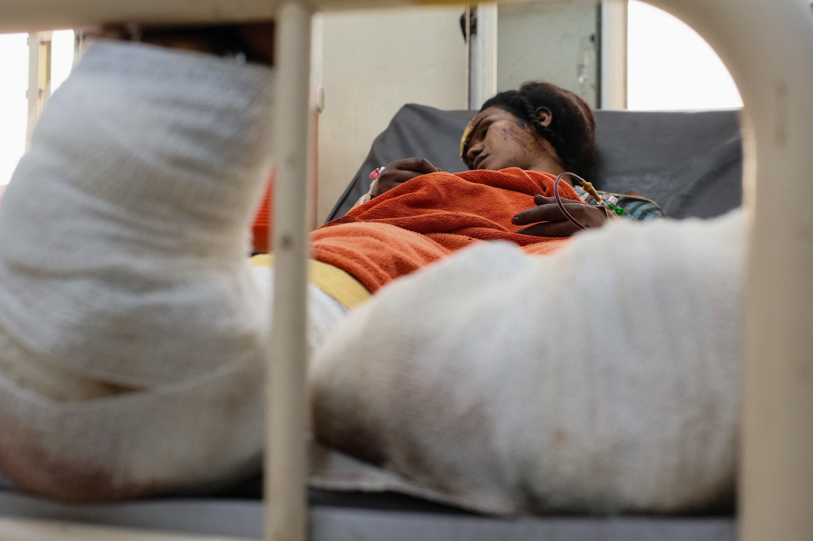 An injured woman recovers in a hospital bed following a drone strike, in Atbara, River Nile State, Sudan, on April 25, 2025.