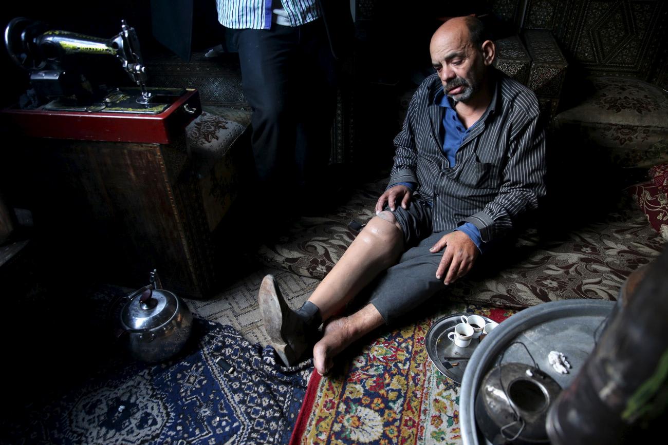 whose leg was amputated due to complications from diabetes, sits in his home in the besieged town of Arbeen, in Damascus suburbs, Syria February 6, 2016.