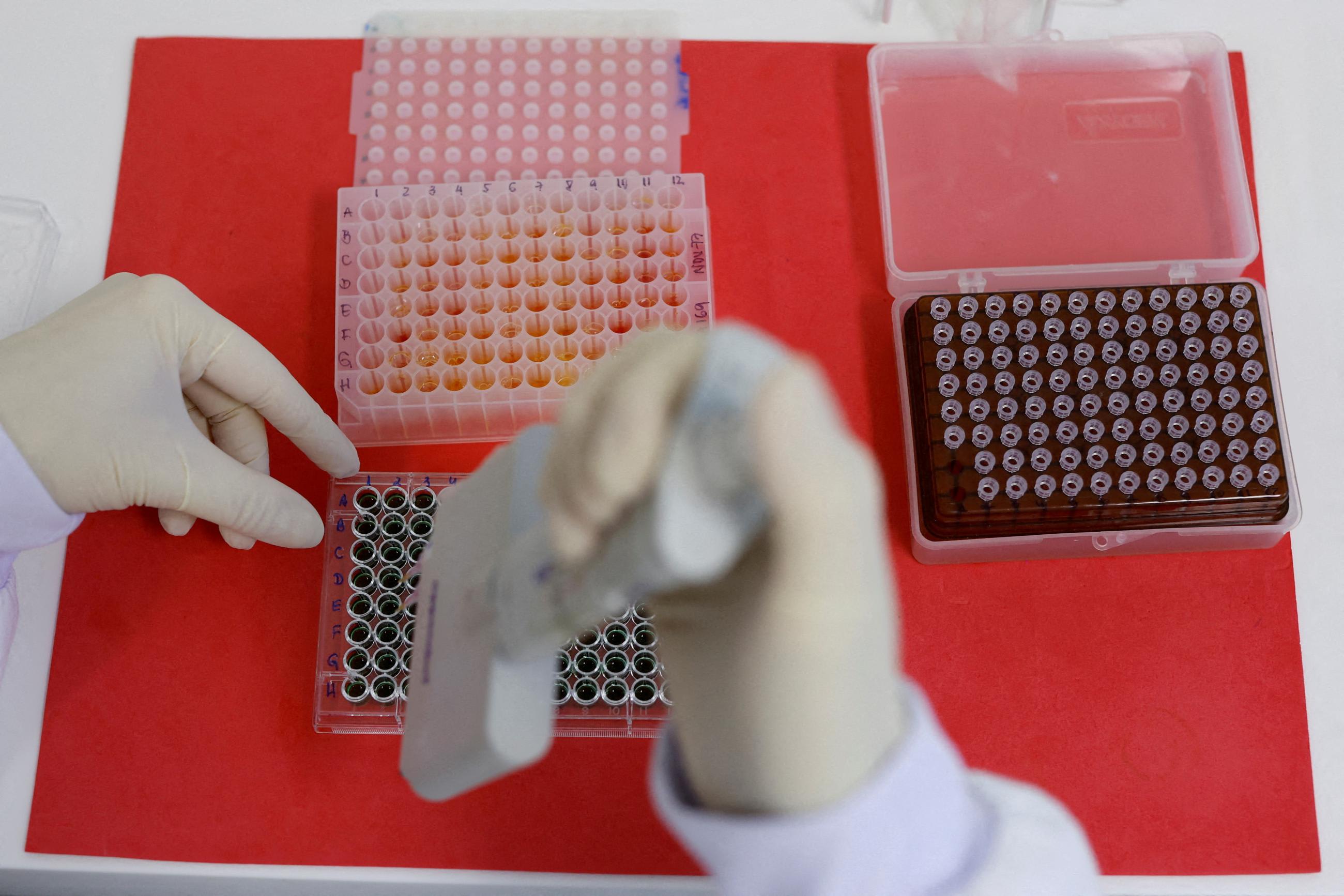 An employee dilutes samples for the detection avian influenza virus antibodies.