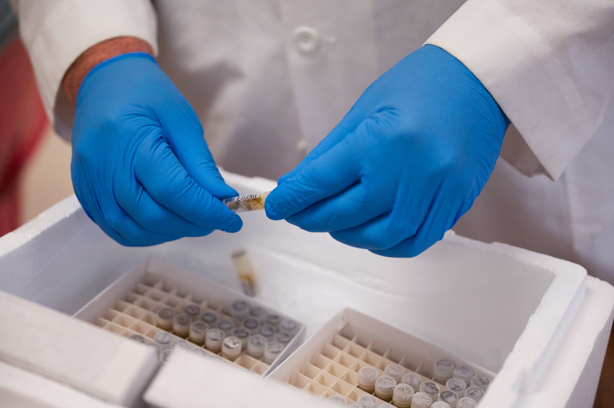 Mark Lockwood, Associate Professor at the University of Illinois Chicago (UIC) College of Nursing, processes a specimen that is part of a study under a RO1 federal grant from the National Institute of Diabetes and Digestive and Kidney Diseases of the National Institutes of Health, at the UIC campus, in Chicago, Illinois, on February 28, 2025.