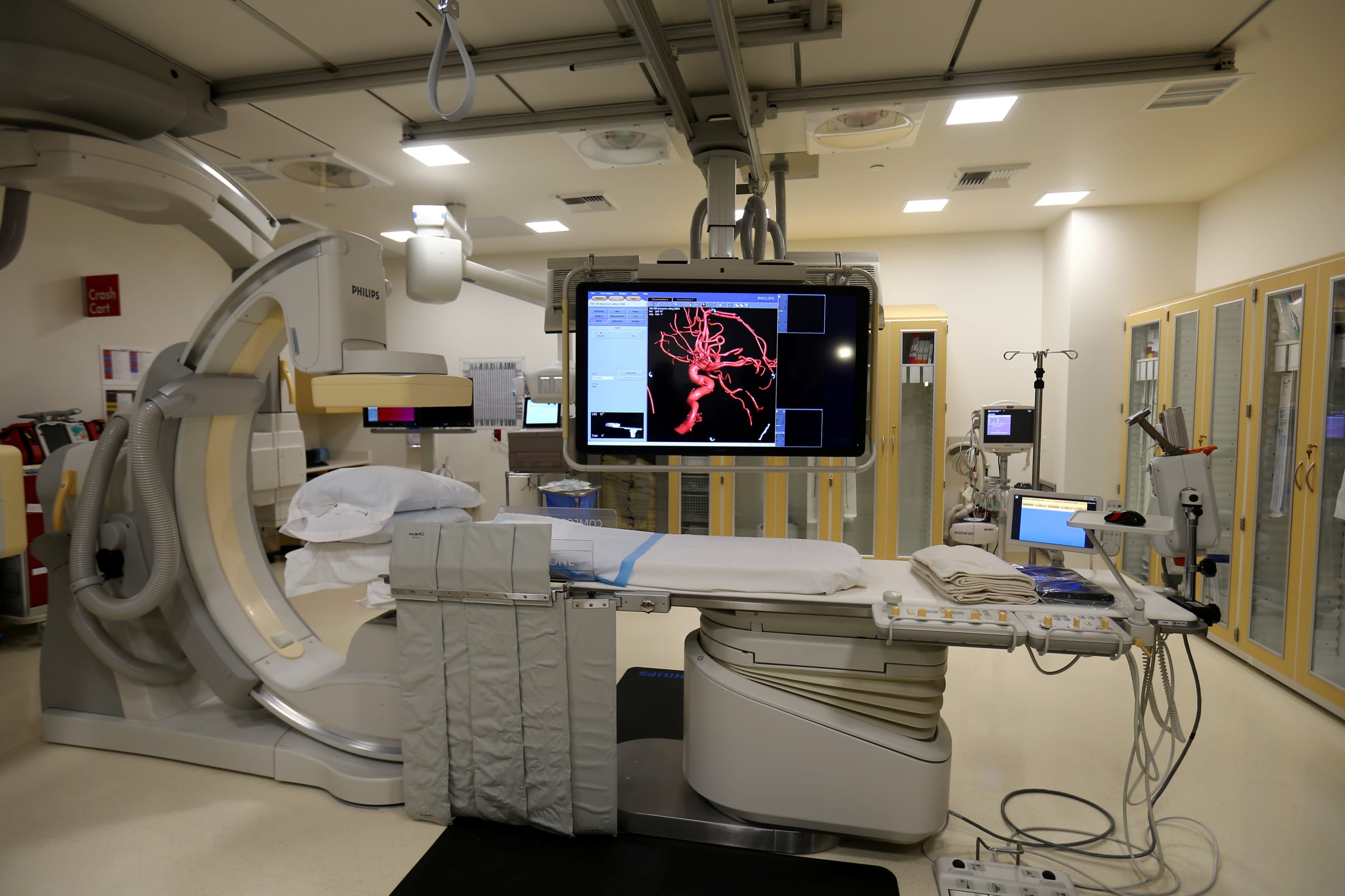 Technology in the Interventional Radiology room is shown at the newly constructed Kaiser Permanente San Diego Medical Center hospital, in San Diego, California, on April 17, 2017.