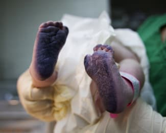 Birth Registration to Improve Health Equity