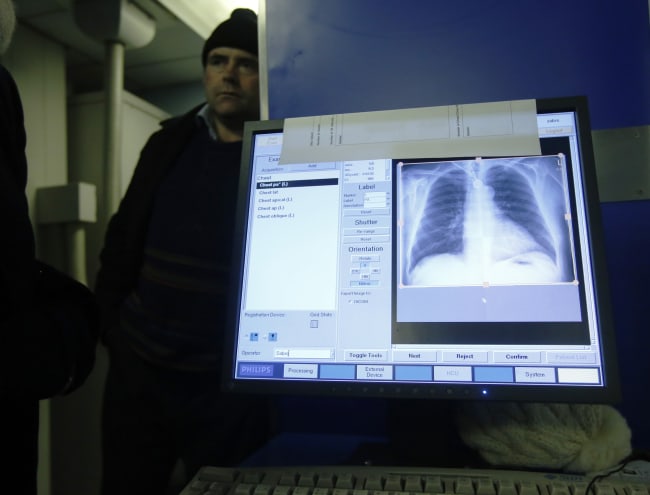 The x-ray scan is shown on a computer after a screening for tuberculosis, in London, England, on January 27, 2014.