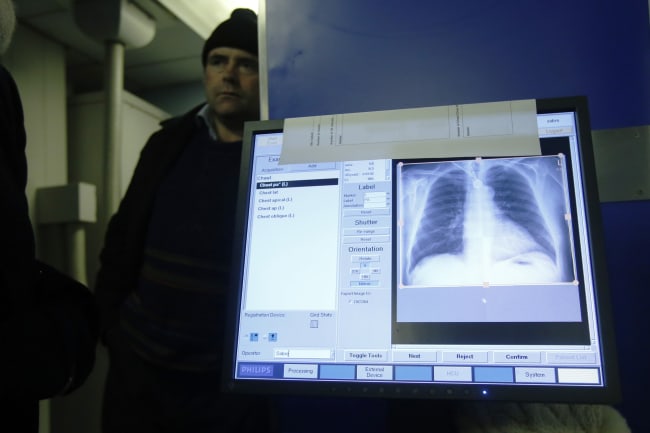 The x-ray scan is shown on a computer after a screening for tuberculosis, in London, England, on January 27, 2014.