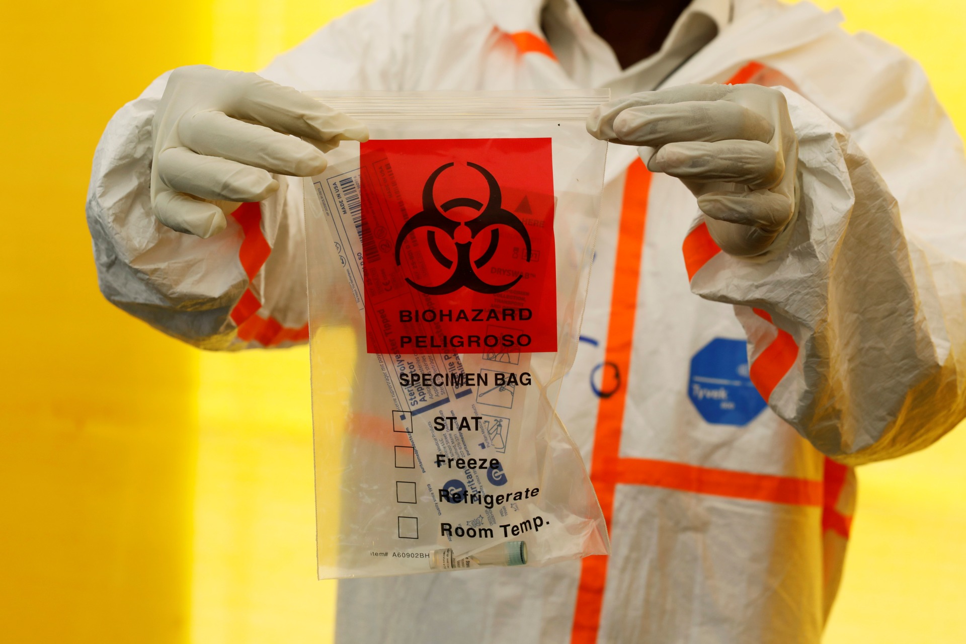 <p>A health worker displays a coronavirus disease (COVID-19) testing kit at a screening and isolation field hospital at a soccer stadium in the town of Machakos, in Machakos county, Kenya, on April 22, 2020.</p>