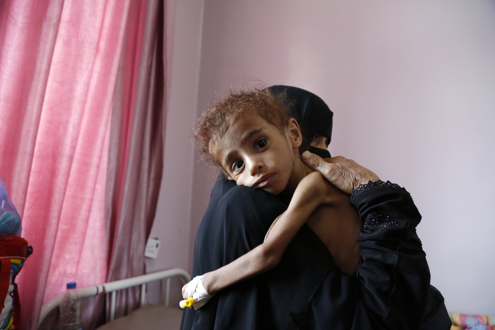 <p>A malnourished child receives treatment in the capital of Sanaa.</p>
