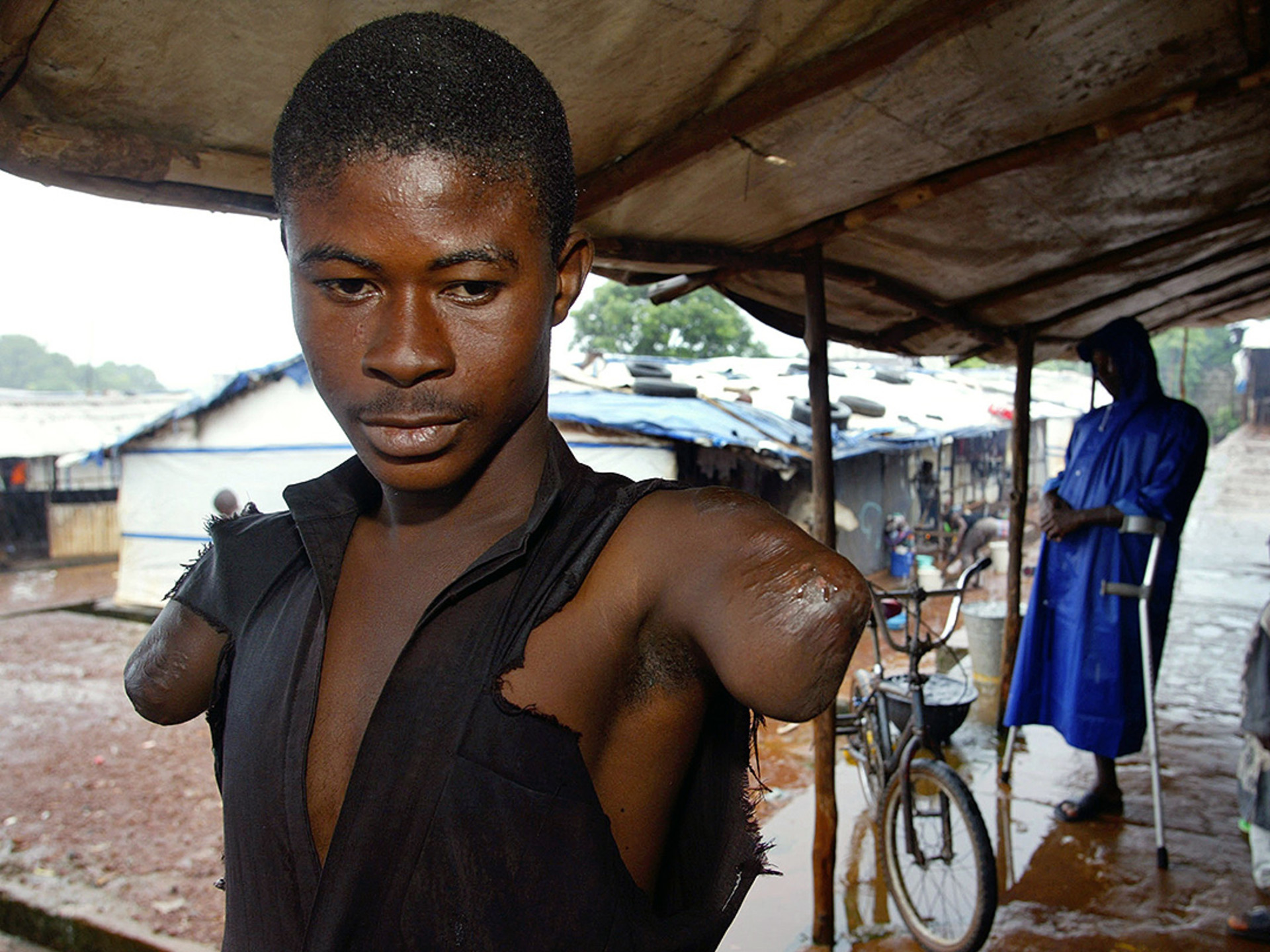 An amputee victim of Sierra Leone’s civil war at a camp in Freetown, Sierra Leone.